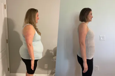 Stephanie Brown Before and After