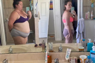 Caitlyn Before and After Surgery