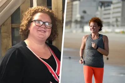 Chelsea Before and After Bariatrics