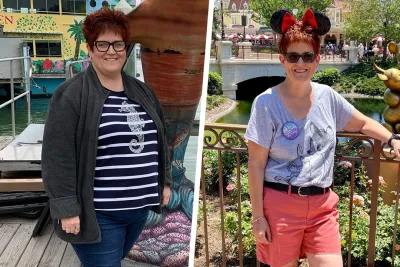 Sarah Before and After Bariatrics