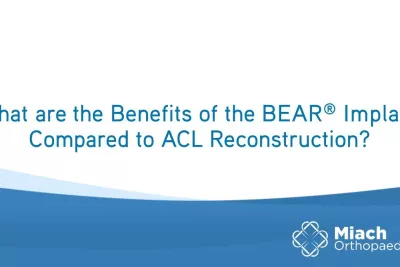 What are the Benefits of BEAR Implant Compared to ACLR? | Q&A | Dr. Sean Keyes | Miach Orthopaedics