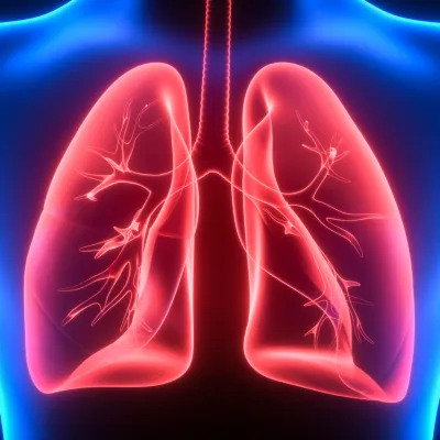 Model of lungs in 3d for lung nodule clinic