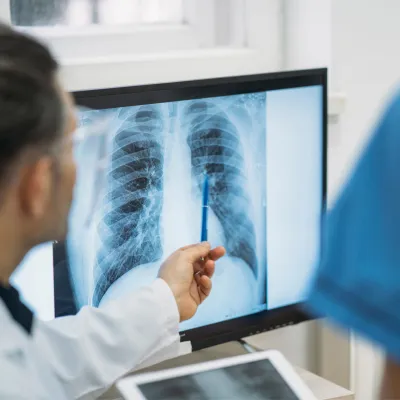 A doctor pointing at a lung in a chest CT scan with a nurse next to him.