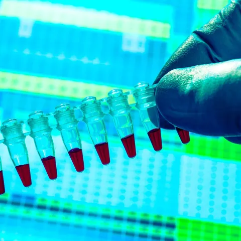 Gloved hand holding genetic sample