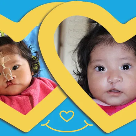 a before and after photo of baby flor