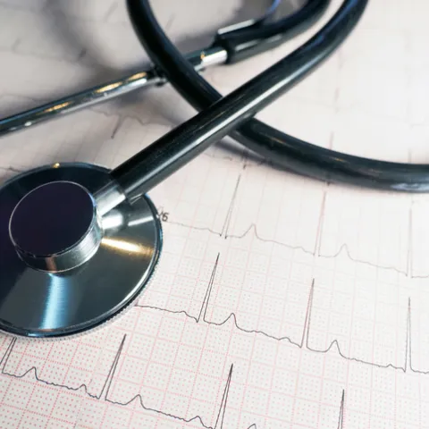 thransthoracic-echocardiogram