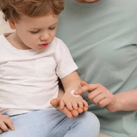 A mother applies calamine lotion to her son's arm.