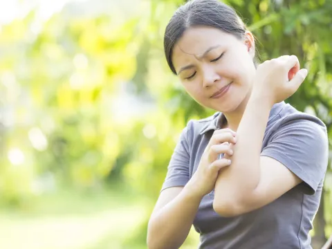 A woman scratches an itchy rash on her arm.