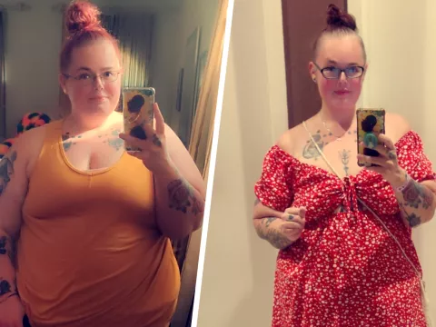 Charlene Bobo before and after bariatric surgery photos.