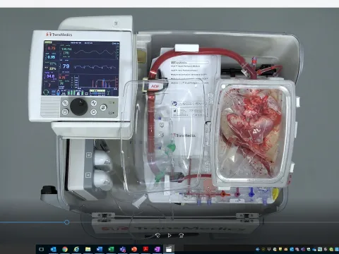 looking down at a device that keeps hearts of diseased donors pumping