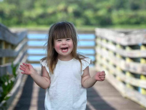 Luna Valle - AHFC Down Syndrome Patient 