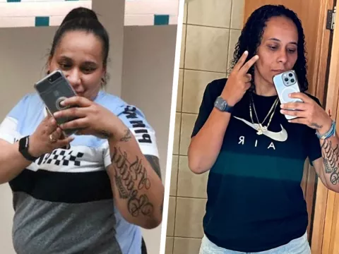 Michelle Before and After Bariatrics