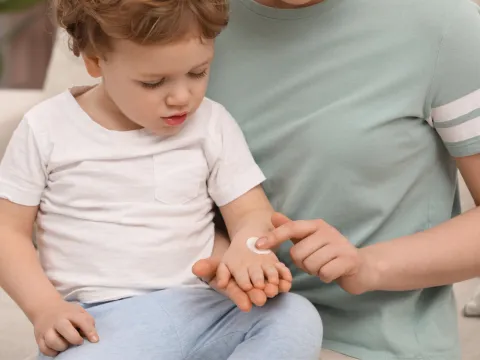A mother applies calamine lotion to her son's arm.