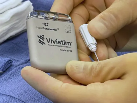 Picture of Vivistim implant device