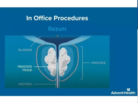 Men's Health Matters - Virtual Urology Event