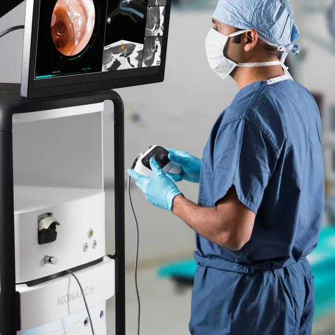 Monarch Bronchoscopy