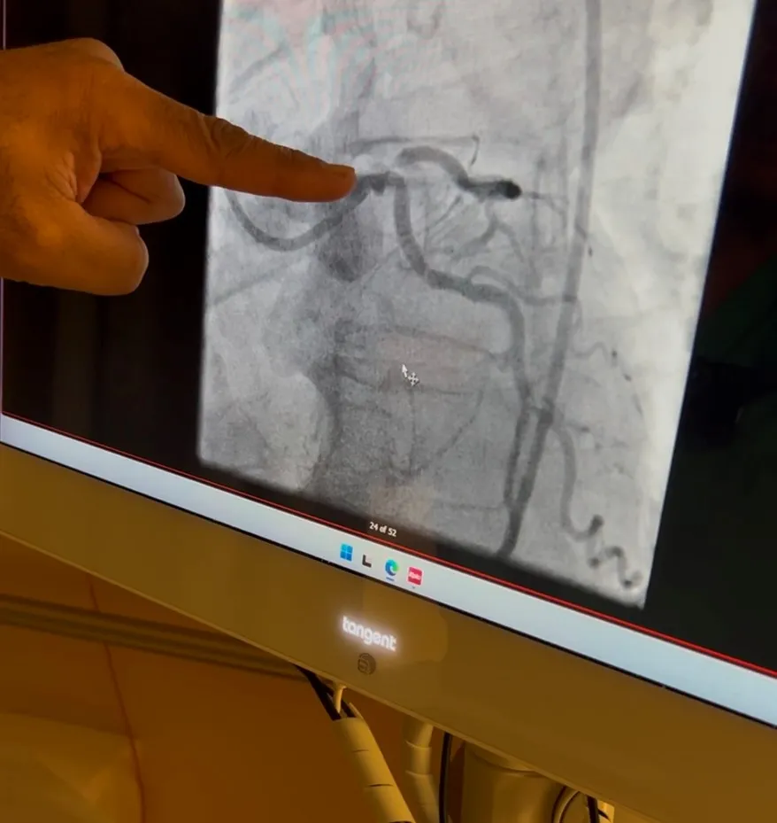 Against All Odds: AdventHealth Daytona Beach Nurses Save Veteran After 45 Minutes of CPR