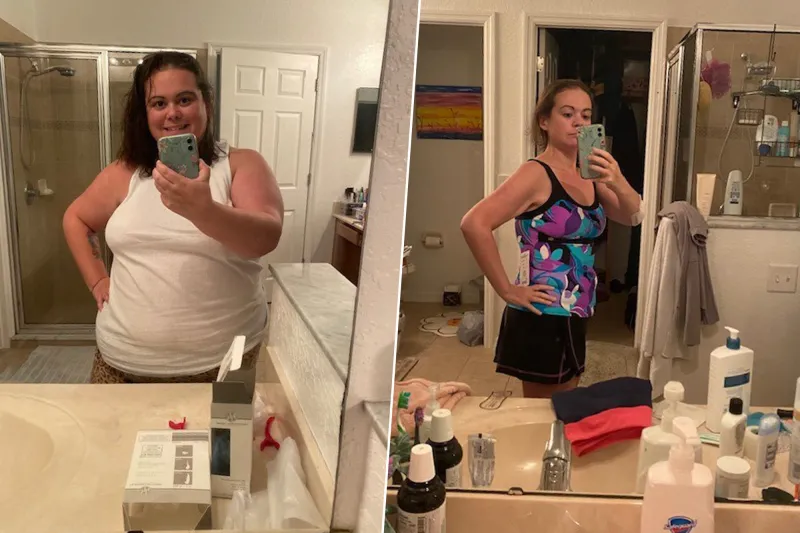 Caitlyn Before and After Surgery