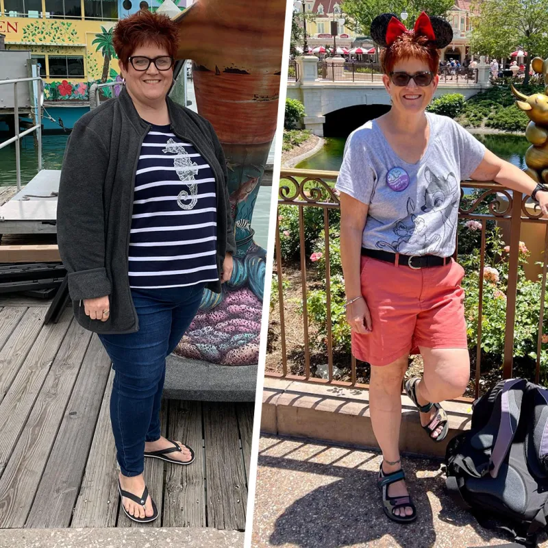 Sarah Before and After Bariatrics